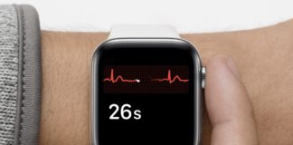 Prevenzione della fibrillazione atriale con Apple Watch: più di 4.300 ECG in due giorni